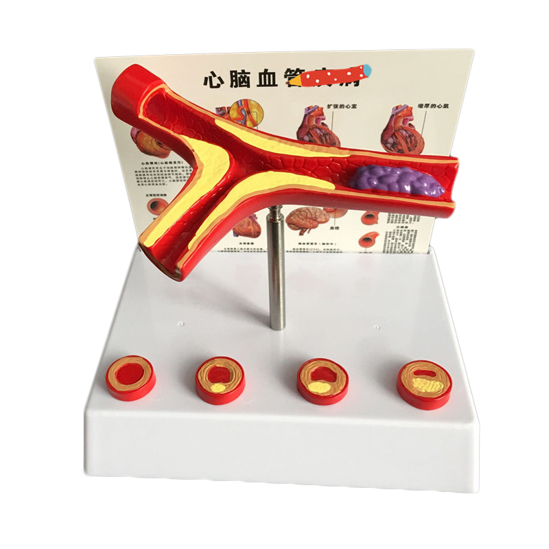 Medical Laboratory Science - Fournitures de laboratoire de modèle vasculaire